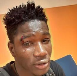 Aggressione razzista Palermo, gli indagati salgono a nove