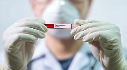 Coronavirus in Sicilia, altri 21 positivi
Nove sono a Ragusa (ma solo 5 migranti)