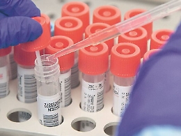 Coronavirus in Sicilia, 198 nuovi casi
Ecco il bollettino del 6 ottobre