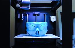 Catania, il volto deformato ricostruito grazie ad una stampante 3D