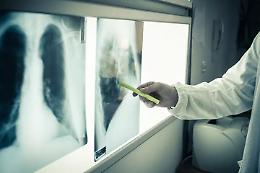 Tumori, la Regione dà il via ai nuovi percorsi terapeutici: ecco gli specialisti che fanno parte della rete oncologica