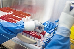 Covid, in Sicilia il virus rallenta la sua corsa e gli ospedali "respirano"