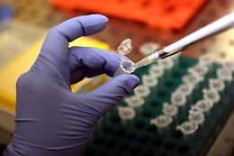Tumori, mutazione gene Egfr nel 20% casi di cancro polmonare