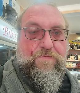 Aggredito a Catania Roman Henry Clarke, "avviso" per la vendita della bottega: &laquo;Me ne vado&raquo;