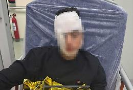 Ragazzino pestato da una baby gang in piazza Stesicoro a Catania: padre posta la foto e scatta l'appello per pi&ugrave; sicurezza